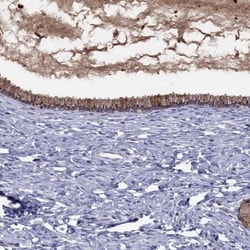 Serpin A3/alpha 1-Antichymotrypsin Antibody, Novus Biologicals 0.1mL; Unlabeled:Antibodies,